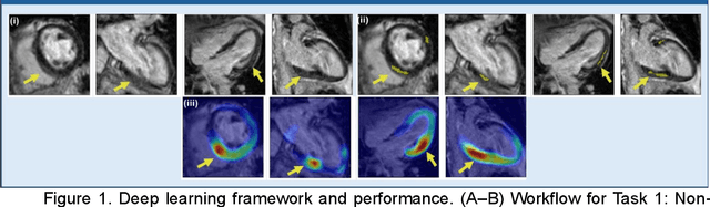 Figure 1 for Assessment of Clonal Hematopoiesis of Indeterminate Potential from Cardiac Magnetic Resonance Imaging using Deep Learning in a Cardio-oncology Population