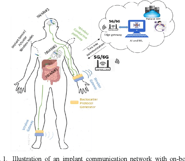 Figure 1 for Design and Implementation of a Hybrid Wireless Power and Communication System for Medical Implants