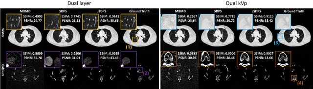 Figure 3 for CT Material Decomposition using Spectral Diffusion Posterior Sampling