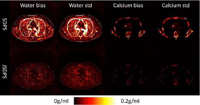 Figure 4 for CT Material Decomposition using Spectral Diffusion Posterior Sampling