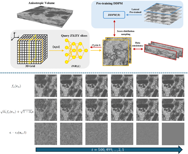 Figure 1 for Reference-free Axial Super-resolution of 3D Microscopy Images using Implicit Neural Representation with a 2D Diffusion Prior