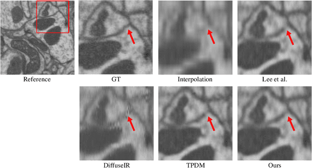 Figure 3 for Reference-free Axial Super-resolution of 3D Microscopy Images using Implicit Neural Representation with a 2D Diffusion Prior
