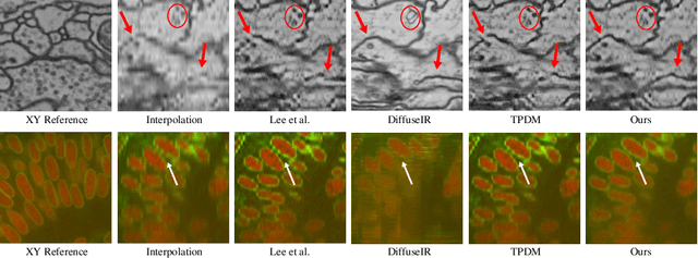 Figure 4 for Reference-free Axial Super-resolution of 3D Microscopy Images using Implicit Neural Representation with a 2D Diffusion Prior