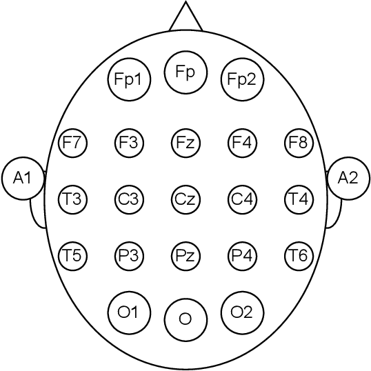 Figure 1 for The use of Multi-domain Electroencephalogram Representations in the building of Models based on Convolutional and Recurrent Neural Networks for Epilepsy Detection