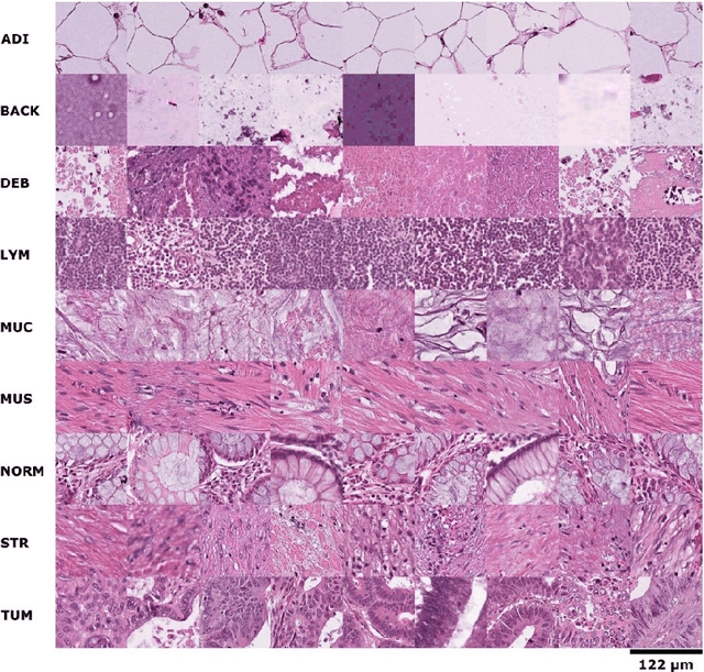 Figure 1 for Sample selection with noise rate estimation in noise learning of medical image analysis