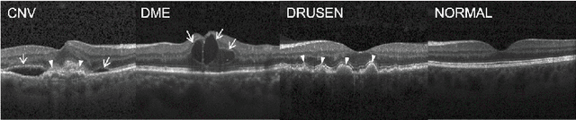 Figure 3 for Sample selection with noise rate estimation in noise learning of medical image analysis