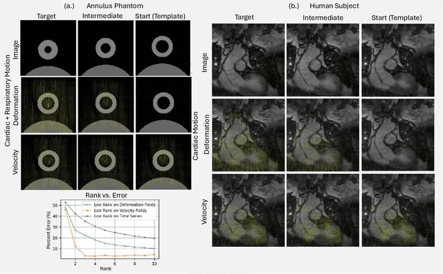 Figure 2 for Motion-compensated cardiac MRI using low-rank diffeomorphic flow (DMoCo)