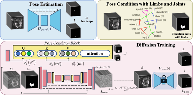 Figure 1 for FetalDiffusion: Pose-Controllable 3D Fetal MRI Synthesis with Conditional Diffusion Model