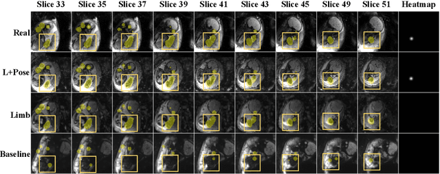 Figure 2 for FetalDiffusion: Pose-Controllable 3D Fetal MRI Synthesis with Conditional Diffusion Model