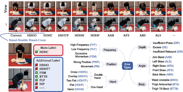 Figure 3 for Multivariate Gaussian Representation Learning for Medical Action Evaluation