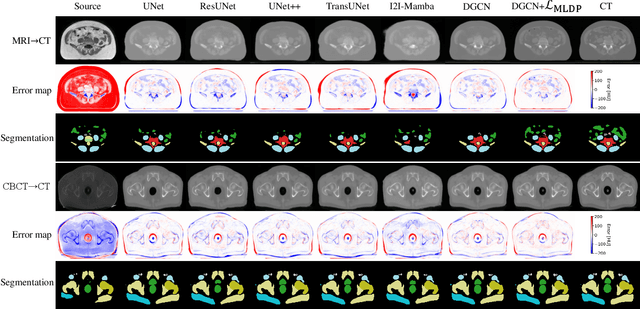 Figure 3 for DINOv3-Guided Cross Fusion Framework for Semantic-aware CT generation from MRI and CBCT