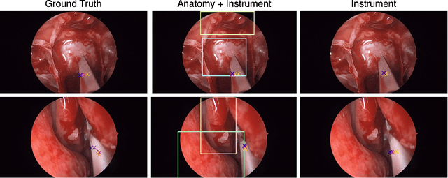 Figure 3 for Anatomy Might Be All You Need: Forecasting What to Do During Surgery