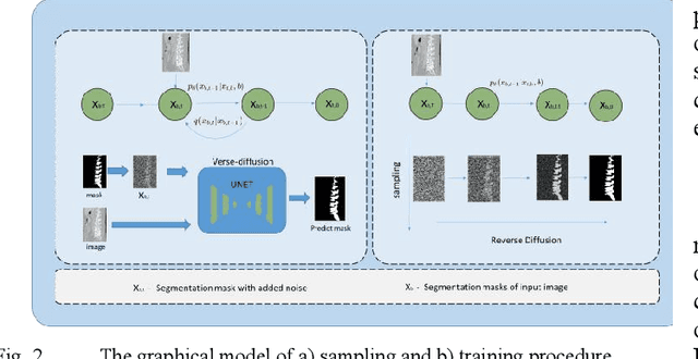 Figure 2 for Introducing Shape Prior Module in Diffusion Model for Medical Image Segmentation