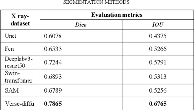Figure 4 for Introducing Shape Prior Module in Diffusion Model for Medical Image Segmentation