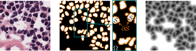 Figure 3 for FlowSDF: Flow Matching for Medical Image Segmentation Using Distance Transforms
