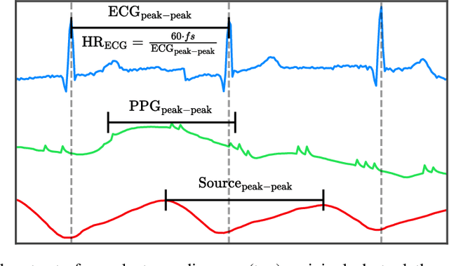 Figure 3 for Self-Supervised Autoencoder Network for Robust Heart Rate Extraction from Noisy Photoplethysmogram: Applying Blind Source Separation to Biosignal Analysis