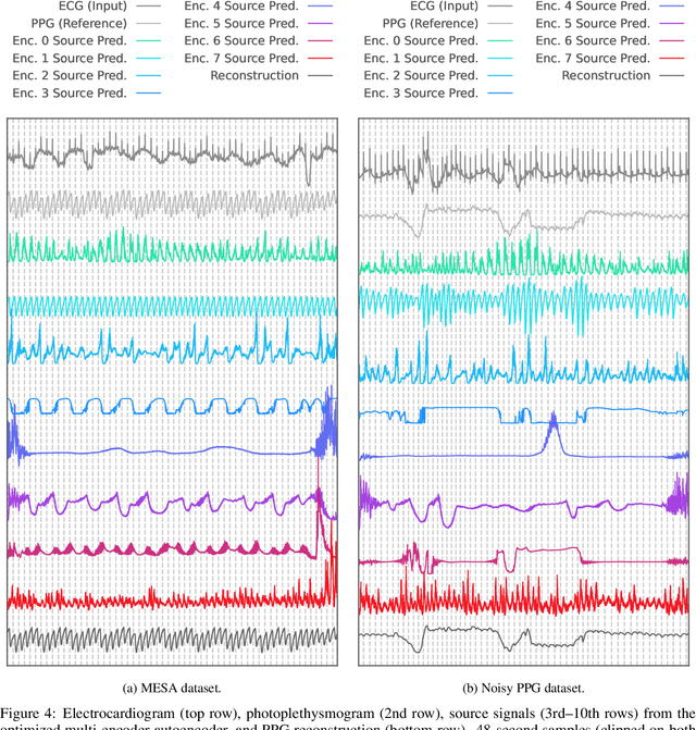 Figure 4 for Self-Supervised Autoencoder Network for Robust Heart Rate Extraction from Noisy Photoplethysmogram: Applying Blind Source Separation to Biosignal Analysis