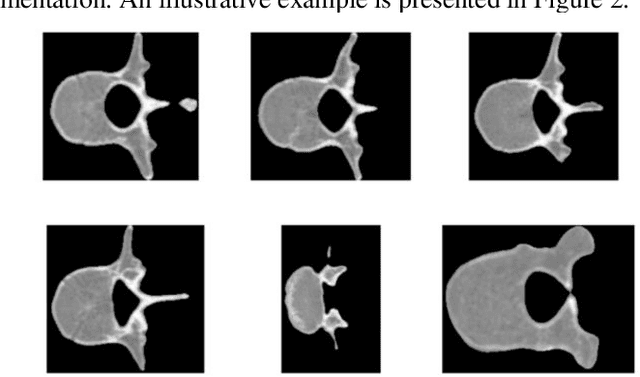 Figure 3 for Adaptive Transformer Attention and Multi-Scale Fusion for Spine 3D Segmentation