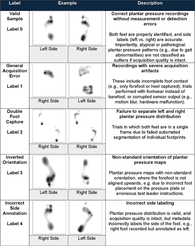 Figure 2 for Outlier Detection in Plantar Pressure: Human-Centered Comparison of Statistical Parametric Mapping and Explainable Machine Learning