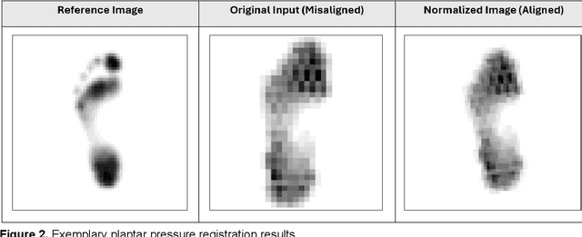 Figure 3 for Outlier Detection in Plantar Pressure: Human-Centered Comparison of Statistical Parametric Mapping and Explainable Machine Learning
