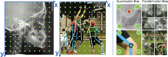 Figure 1 for Revisiting Cephalometric Landmark Detection from the view of Human Pose Estimation with Lightweight Super-Resolution Head