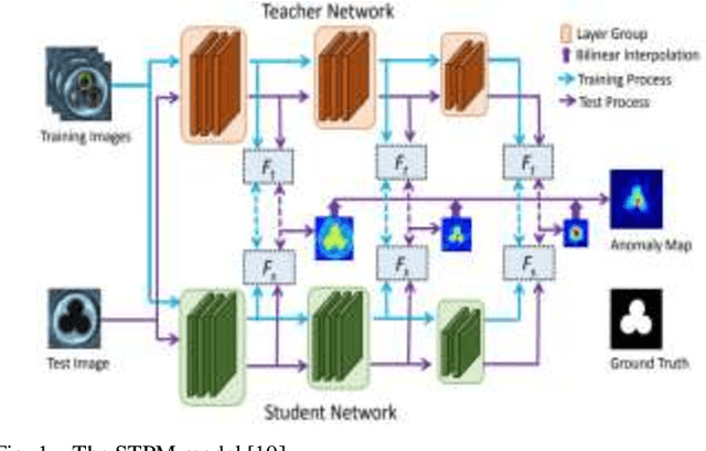 Figure 1 for Unsupervised Anomaly Detection with an Enhanced Teacher for Student-Teacher Feature Pyramid Matching
