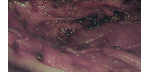 Figure 1 for Automatic Tissue Differentiation in Parotidectomy using Hyperspectral Imaging