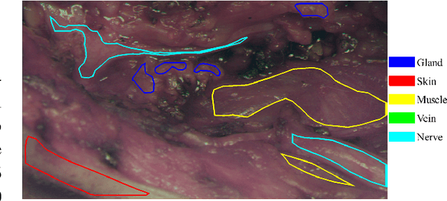 Figure 2 for Automatic Tissue Differentiation in Parotidectomy using Hyperspectral Imaging