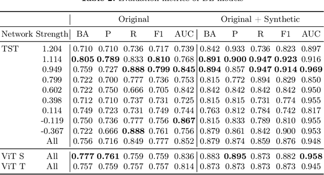 Figure 4 for Synthetic Electroretinogram Signal Generation Using Conditional Generative Adversarial Network for Enhancing Classification of Autism Spectrum Disorder