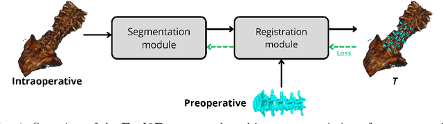 Figure 1 for End2Reg: Learning Task-Specific Segmentation for Markerless Registration in Spine Surgery