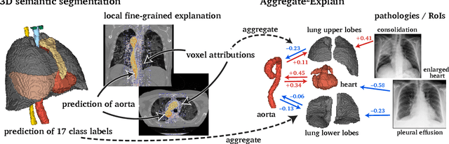 Figure 1 for Aggregated Attributions for Explanatory Analysis of 3D Segmentation Models