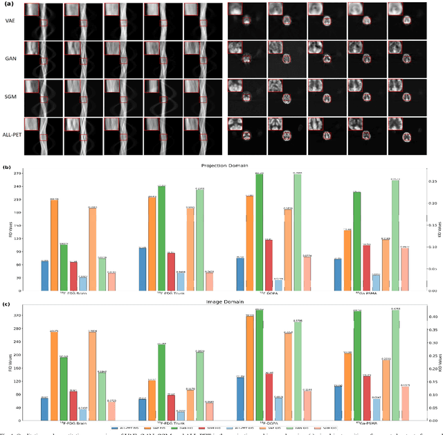 Figure 3 for ALL-PET: A Low-resource and Low-shot PET Foundation Model in the Projection Domain