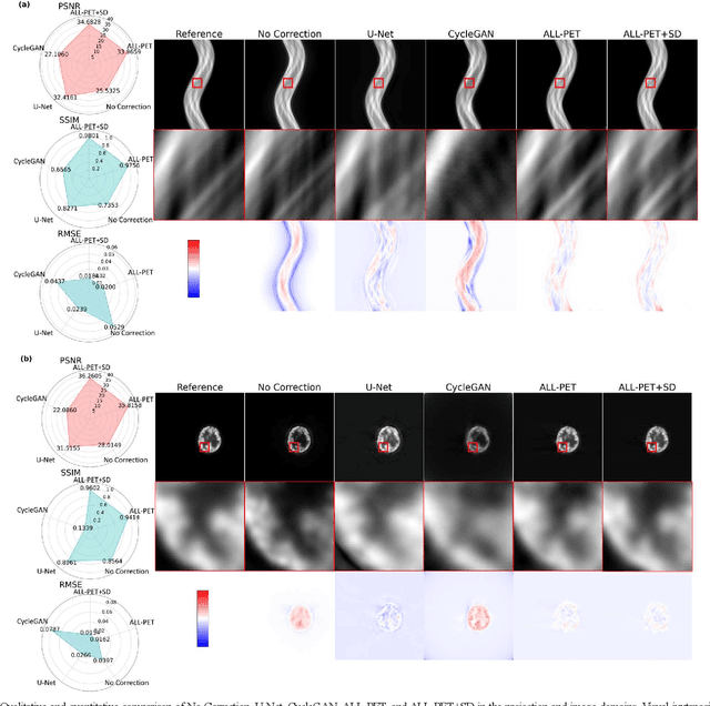 Figure 4 for ALL-PET: A Low-resource and Low-shot PET Foundation Model in the Projection Domain