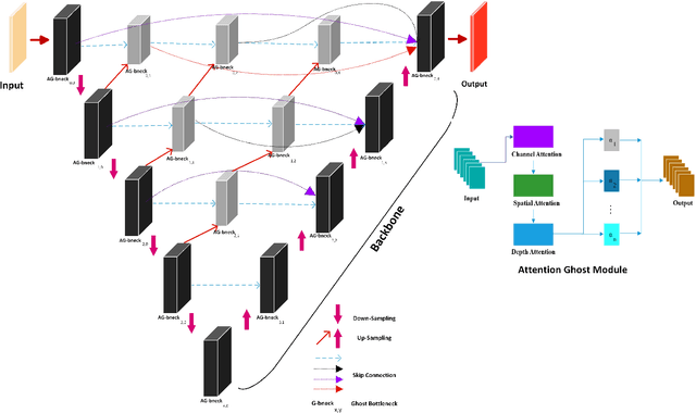 Figure 1 for Attention GhostUNet++: Enhanced Segmentation of Adipose Tissue and Liver in CT Images