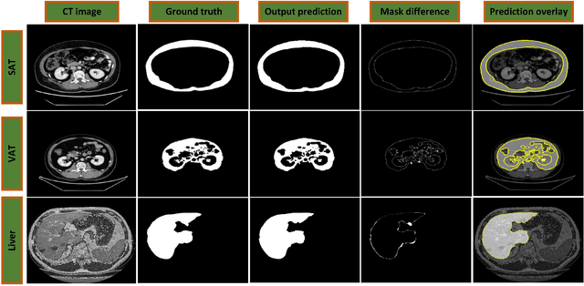 Figure 2 for Attention GhostUNet++: Enhanced Segmentation of Adipose Tissue and Liver in CT Images