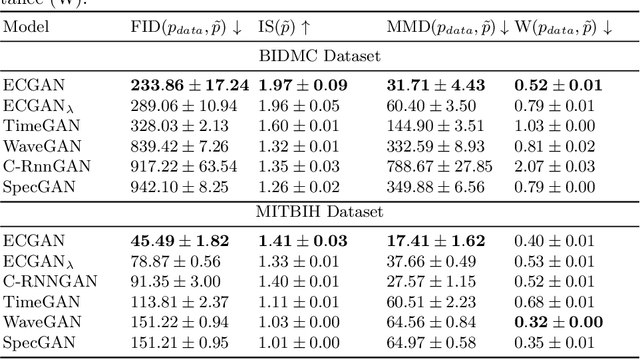 Figure 2 for ECGAN: Self-supervised generative adversarial network for electrocardiography