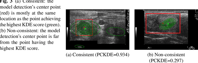 Figure 4 for Towards Trust of Explainable AI in Thyroid Nodule Diagnosis