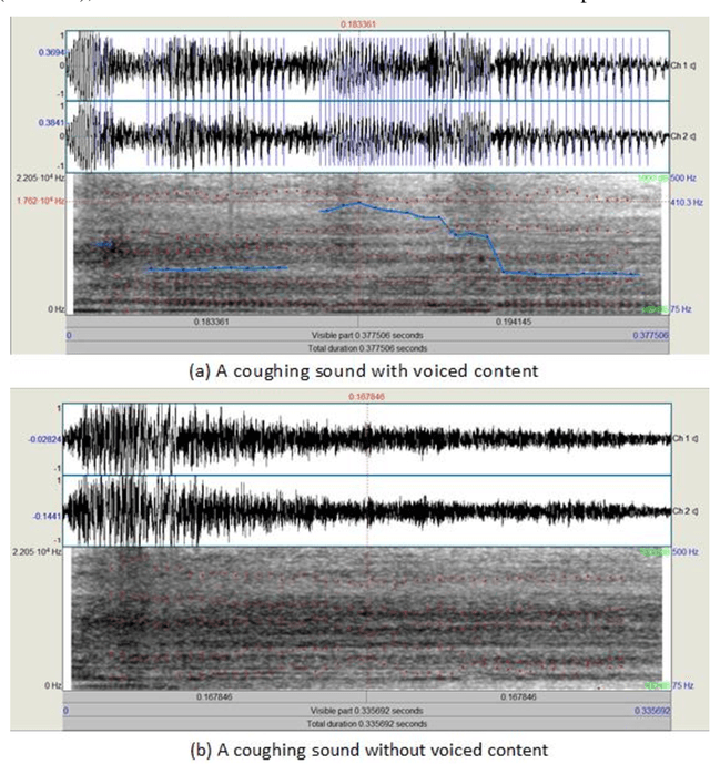 Figure 1 for Characterization of cough sounds using statistical analysis