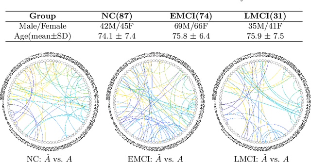 Figure 2 for Brain Diffuser: An End-to-End Brain Image to Brain Network Pipeline