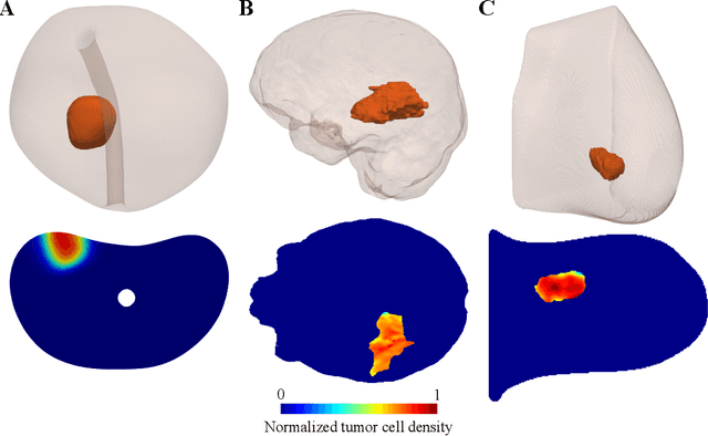 Figure 3 for Patient-specific, mechanistic models of tumor growth incorporating artificial intelligence and big data