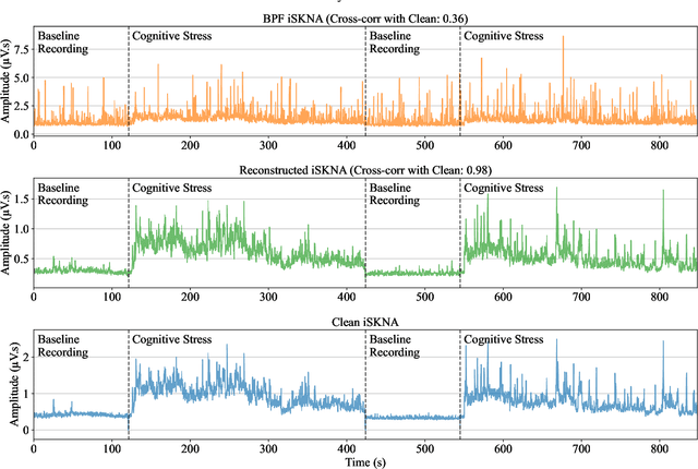 Figure 2 for Autoencoder-Based Denoising of Muscle Artifacts in ECG to Preserve Skin Nerve Activity (SKNA) for Cognitive Stress Detection