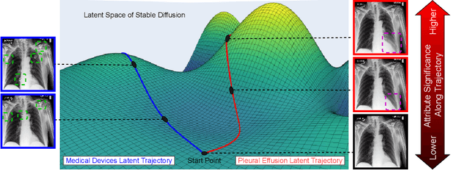 Figure 1 for Language-Guided Trajectory Traversal in Disentangled Stable Diffusion Latent Space for Factorized Medical Image Generation