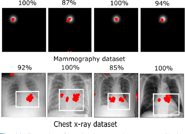 Figure 3 for Revisiting model self-interpretability in a decision-theoretic way for binary medical image classification