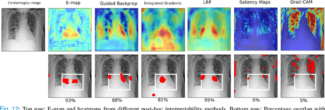 Figure 4 for Revisiting model self-interpretability in a decision-theoretic way for binary medical image classification