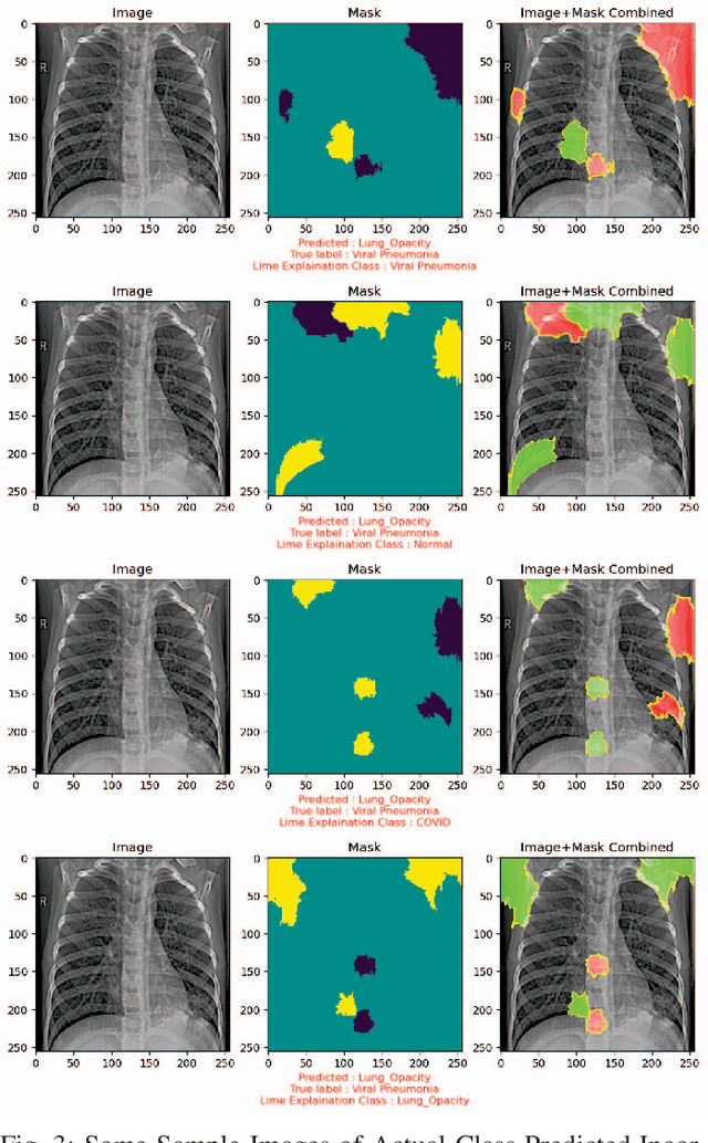 Figure 3 for A Comprehensive Analysis of COVID-19 Detection Using Bangladeshi Data and Explainable AI