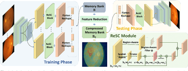 Figure 1 for Region and Spatial Aware Anomaly Detection for Fundus Images