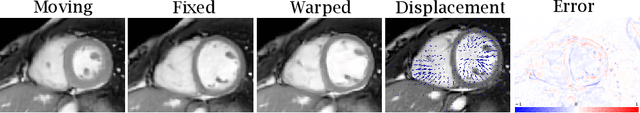 Figure 3 for Deep Learning for Automatic Strain Quantification in Arrhythmogenic Right Ventricular Cardiomyopathy