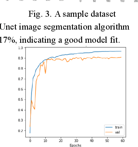 Figure 4 for Residual Connection Networks in Medical Image Processing: Exploration of ResUnet++ Model Driven by Human Computer Interaction