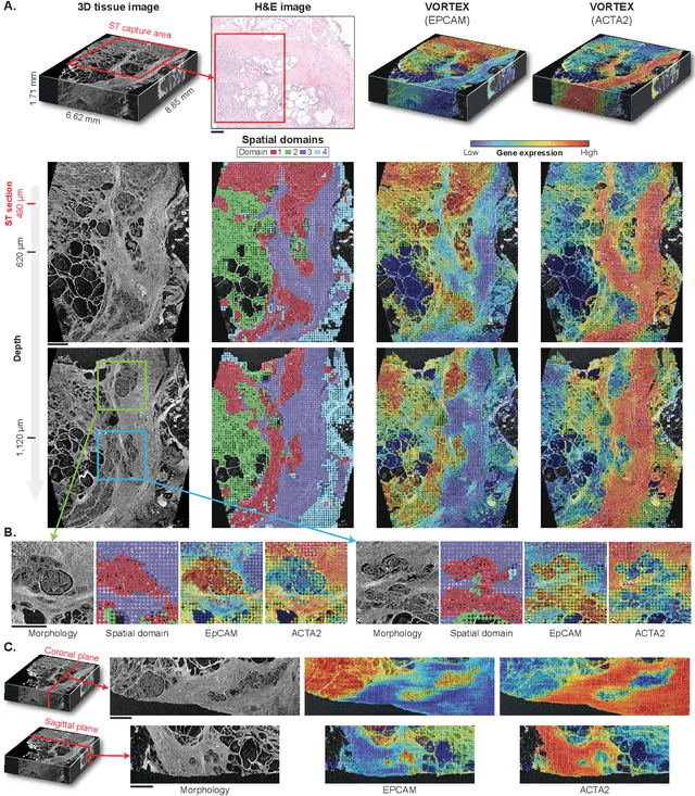 Figure 3 for AI-driven 3D Spatial Transcriptomics
