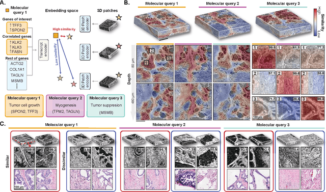 Figure 4 for AI-driven 3D Spatial Transcriptomics
